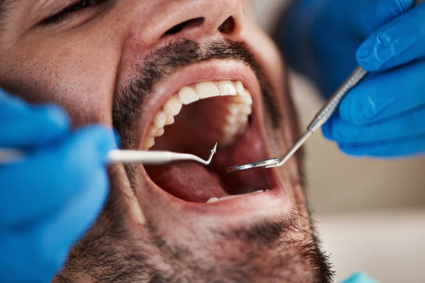 Best Emergency Treatment for Dental Infections or Abscesses in Eagle, WI